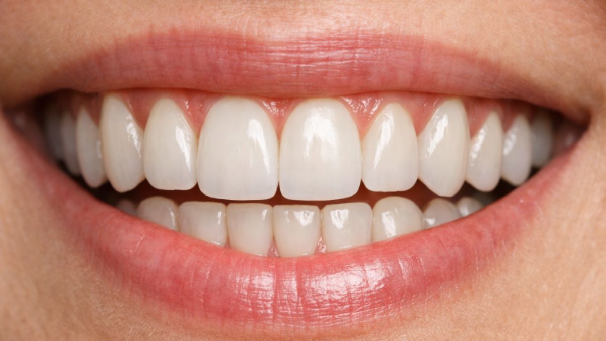 Dental implants