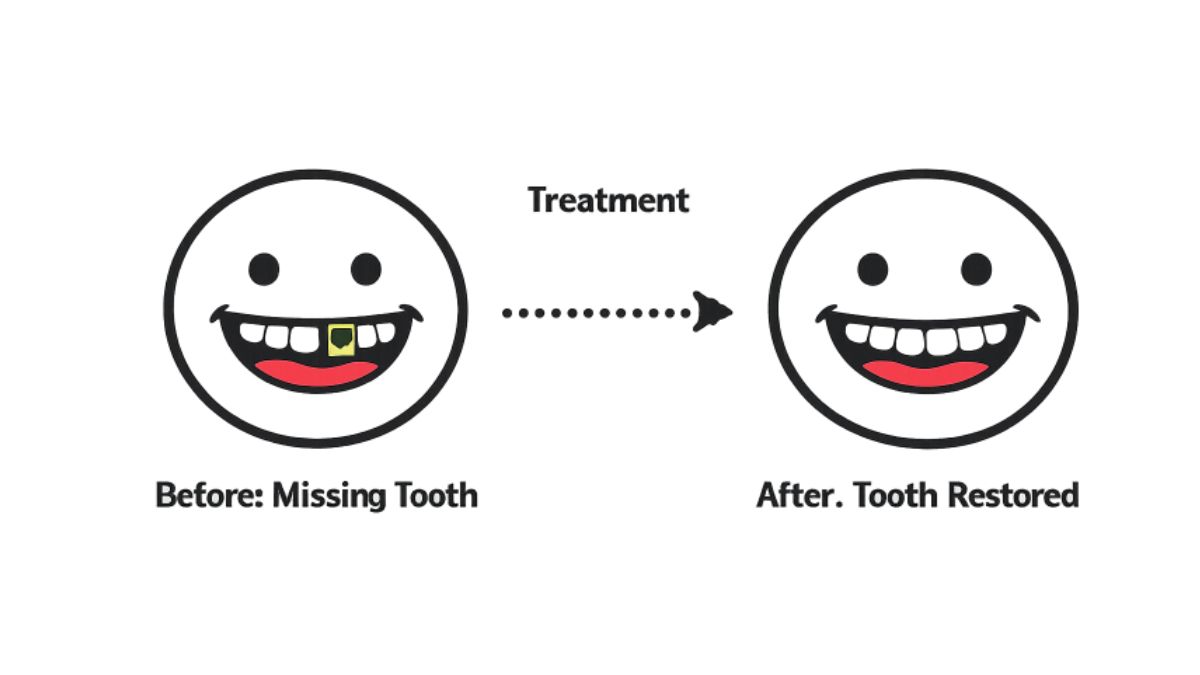 Missing Teeth
